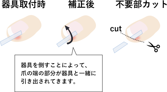 器具の取り付け、補正