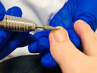 痛みのない治療