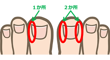 補正箇所説明イラスト